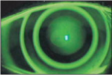 Figure 6. Dual Geometric Design (Global OK).