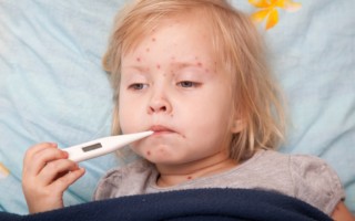 Small child with Measles