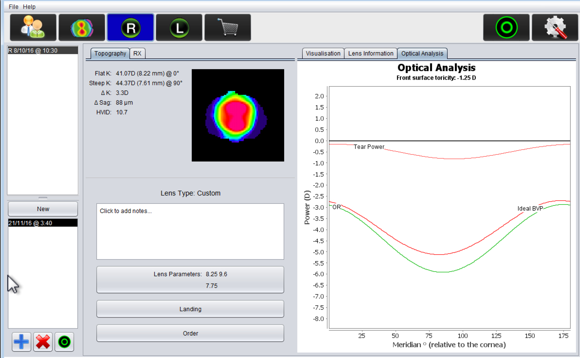 EyeSpaceopticalanalysis Charl Laas Optometrists